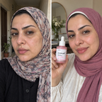 Medicube PDRN Serum